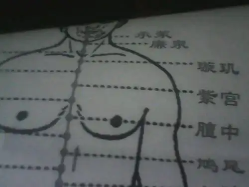 33岁,两乳房之间偏左下方间歇性疼痛,针扎的感觉.