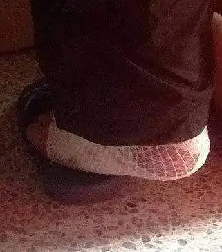 抖腿到底是不是种病