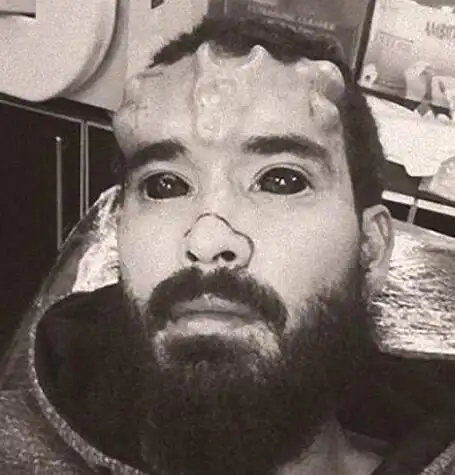 男子整容成真人版"红骷髅"