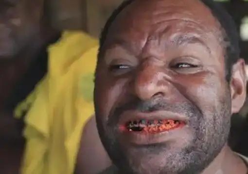 被槟榔毁掉的国家6岁小孩都在吃槟榔路上到处是红色血水