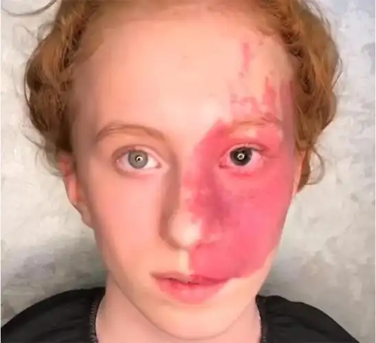 淡妆浓抹总相宜半脸胎记钟无艳60岁黑黄大妈妆后判若两人