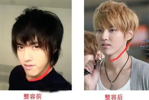 kris吴亦凡整容前 kris吴亦凡手臂纹身