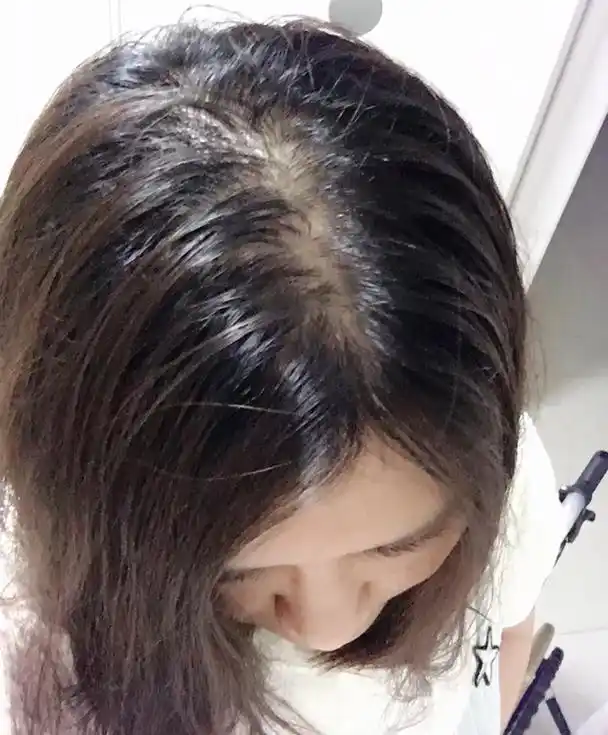 为什么刚洗完头发,没多久就"油腻"?可能是这3点"中招"了