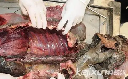 尸体解剖的介绍