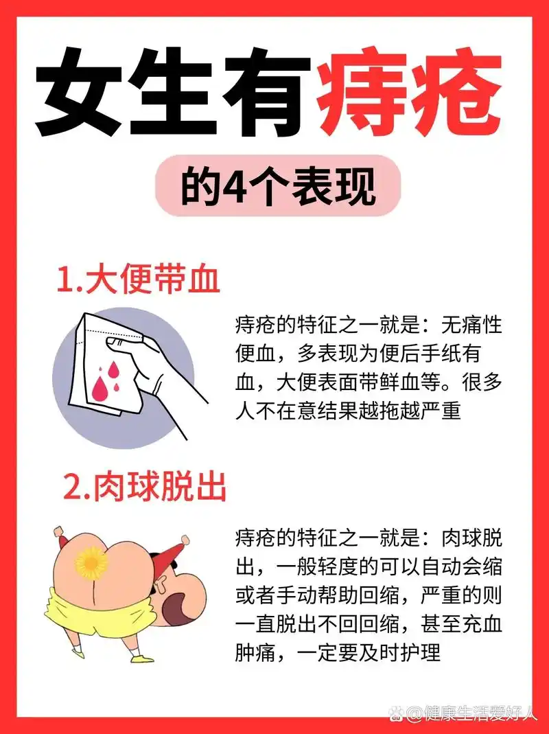 女生有痔疮的4个表现6015一秒自测:这法子巨牛