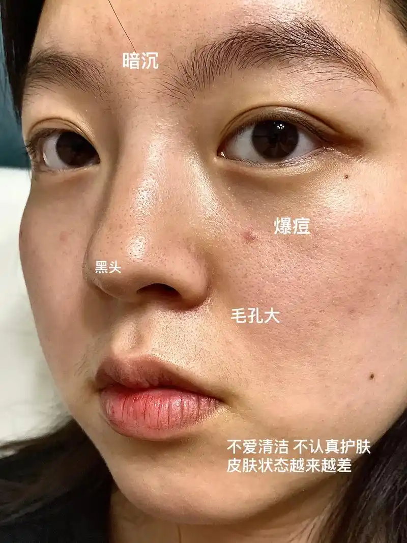 希望我们都是苦尽甘来的人,好吗#素颜 #好皮肤#毛孔粗大 # - 抖音