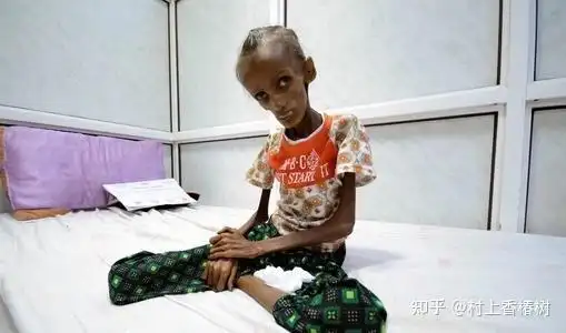 孩子七八岁长得瘦小,不爱吃饭,是否父母的不良影响造成? - 知乎