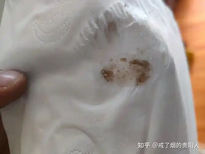 戒烟后吐出来的黑痰是什么物质
