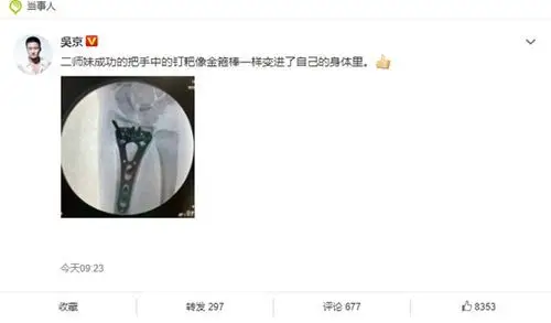 吴京晒谢楠桡骨钢钉照盘点骨折过的女明星