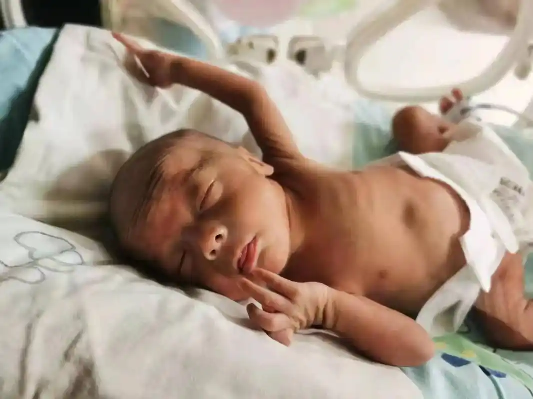 早产儿加油 这是宝宝今天的照片,昨晚和主管医生聊完,我心情 - 抖音