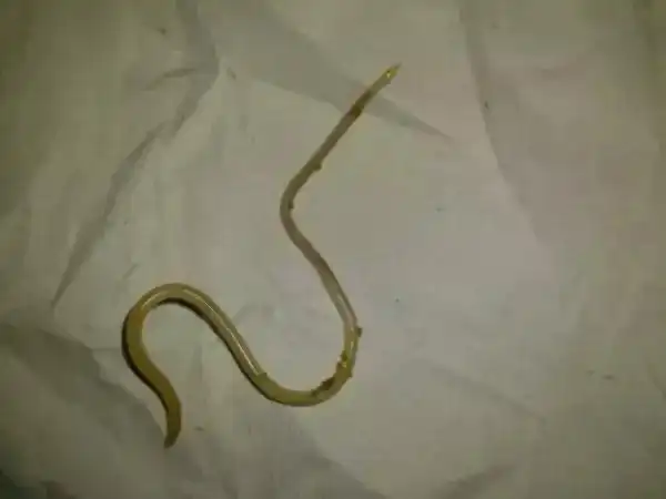 孩子肚子里怎么会有蛲虫?该怎么办?