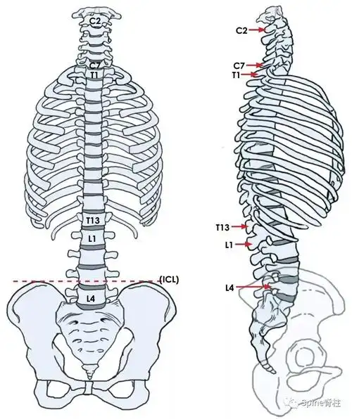 不典型脊柱|x线片|脊柱|椎体|腰椎|-健康界