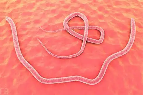 寄生虫钻进美女身体里 - 搜狗英文