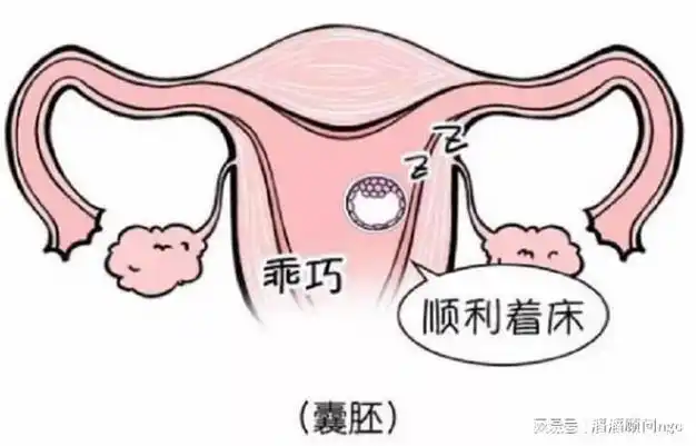 滔滔顾问俄罗斯试管婴儿三代移植后什么时候着床成功好孕