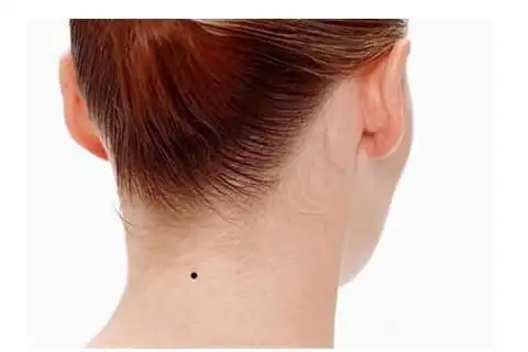 锁骨与膊头之间的痣锁骨与膊头之间有痣的人,往往代表理财能力差,花钱