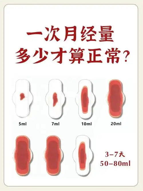 一篇告诉你月经量多少才算正常差距大要72