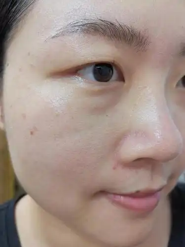 本人敏感混合型肤质,冬天偏干,脸颊鼻翼毛孔明显,脸上有斑,照片无ps