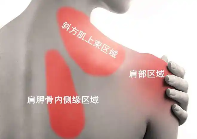 肩膀疼痛是怎么回事9种病因告知您再也不盲目咨询