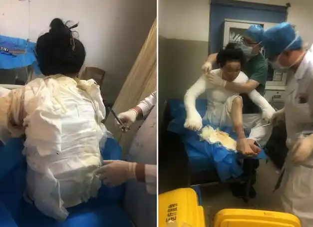 发生悲剧,从此全身戴上"紧箍咒"|烧伤|瘢痕|手术|医生|治疗_网易订阅