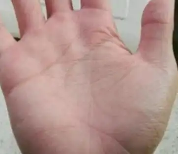 三角纹唯独不宜出现在手掌"坎宫",会受到刑克而孤寡!