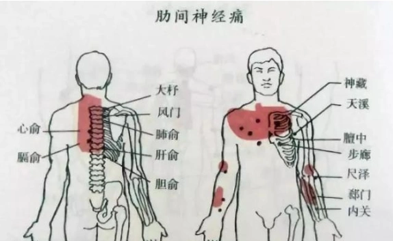 肋骨软骨炎|左侧肋骨下方疼痛是怎么回事?医生盘点:多半是这5种疾病
