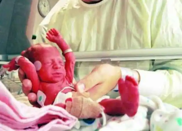 同样是足月儿37周和40周出生的宝宝差距不只一点点