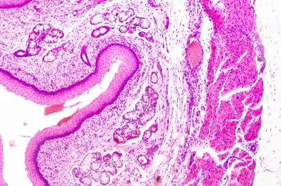 复层鳞状上皮图片