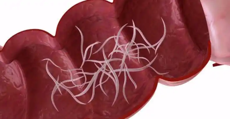 2招可治它_蛲虫_虫卵_蛔虫