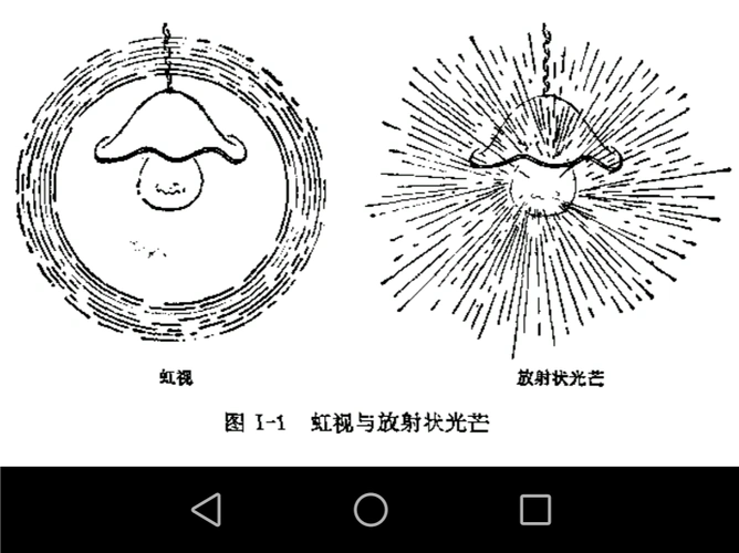 眼科常见症状之虹视