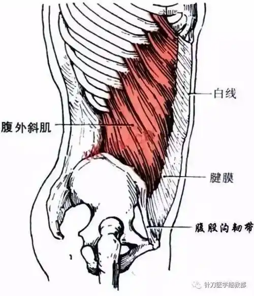 肋痛腹外斜肌损伤的针刀治疗