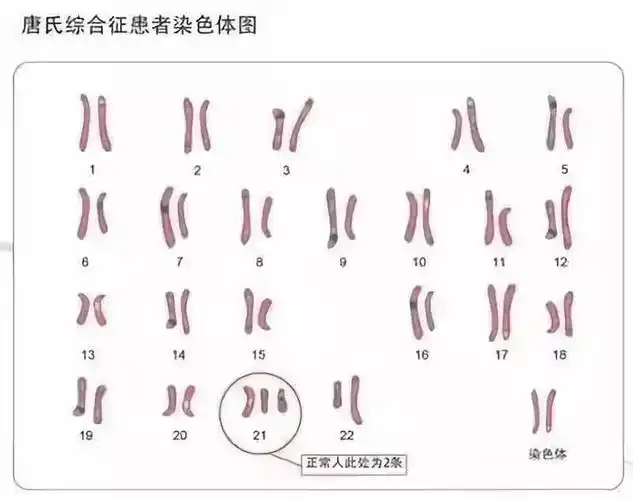 图片-克氏综合征染色体核型图片/正常男性染色体核型1.