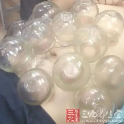 拔罐的作用 拔罐如何治疗腹痛
