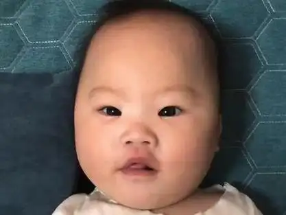 唐氏儿宝宝 很多朋友看了宝宝照片都说唐氏特征不明显,那发个视频给