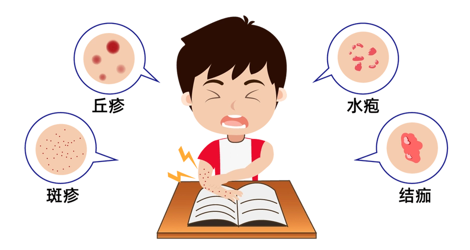 猴痘尚远水痘很近