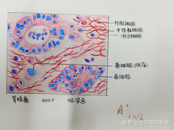 病理红蓝铅笔绘图