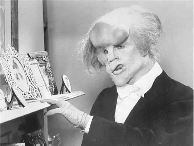 怪异被人戏称为"象人",一生坎坷,最终结局更是令人唏嘘_瑟夫·梅里克