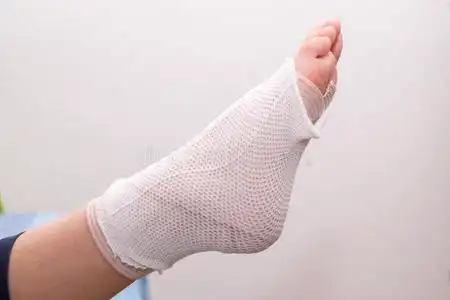 脚部用绷带包扎脚伤,脚扭伤,脚踝扭伤照片