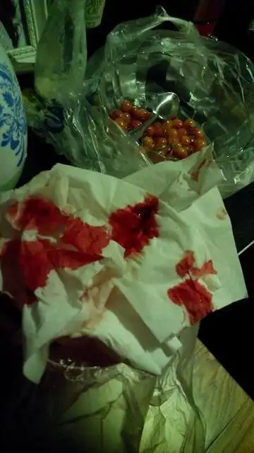 还有垃圾桶里的纸都是血,现在鼻子被纸堵上了!