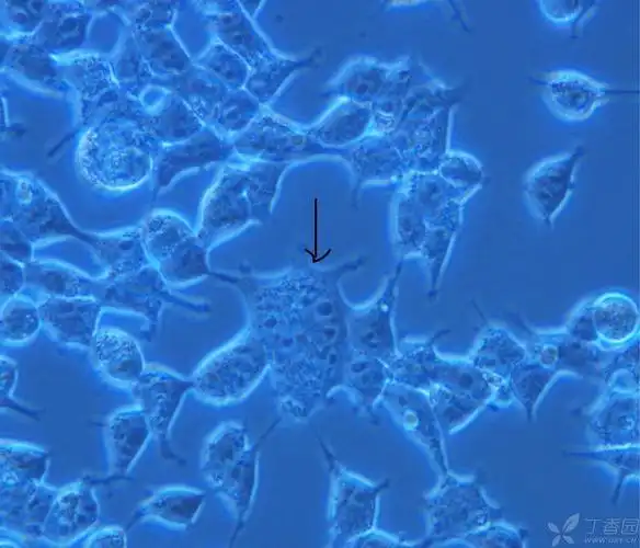 我们实验室在2009年在上海细胞库买了一株hek 293t细胞.