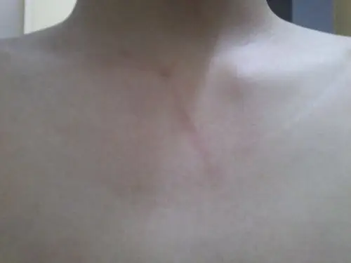 13:17青春在冒烟|二级 天生的话是正常现象,人不可能长得很对称