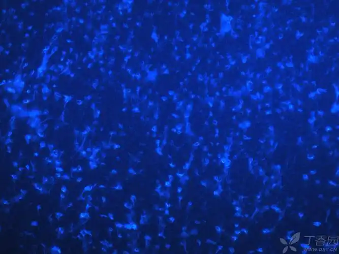 急求帮助, 最近做免疫荧光  ,最后核染色用的是直接带有dapi