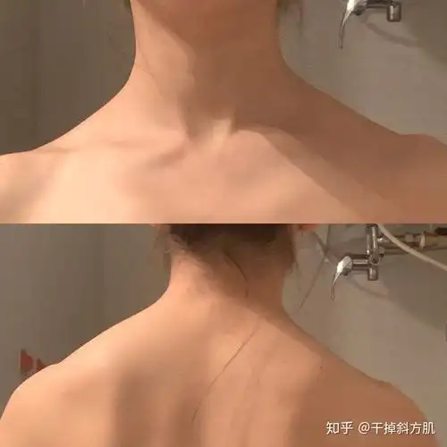 来看看我的斜方肌 - 知乎