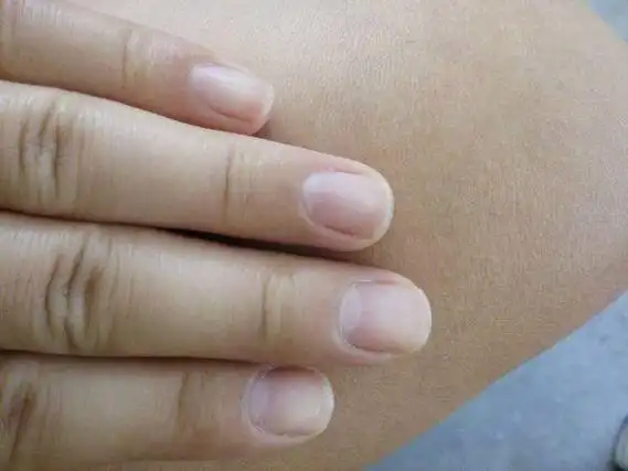 每个人的正常指甲是怎么样的