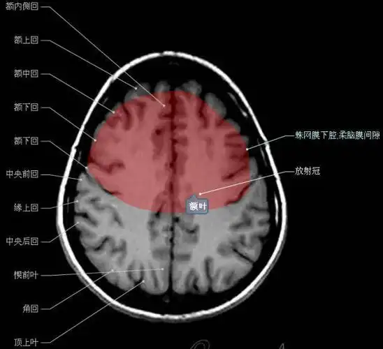 神经解剖| 头颅mr轴位解剖图