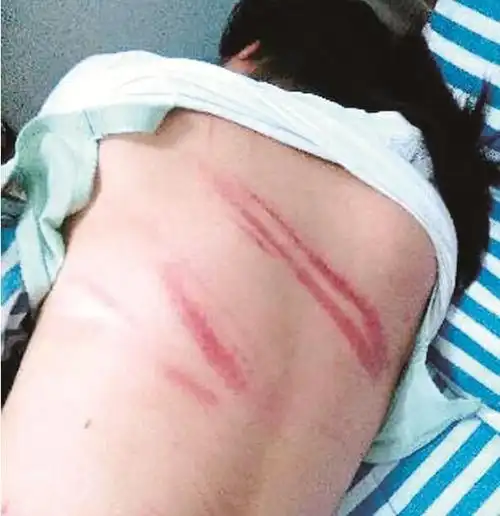 数名男子当街挥舞棍棒殴打早点摊主 致两名伤者住院