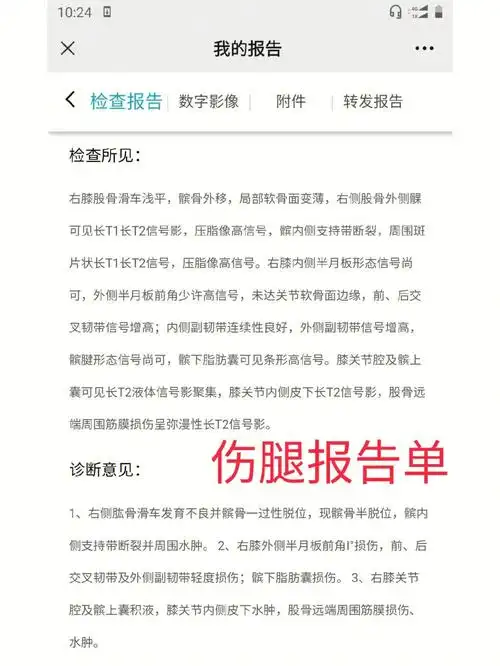 可能我长出来就是【髌骨半脱位】吧