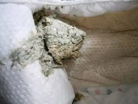 宝宝拉这样白色的屎是什麼原因