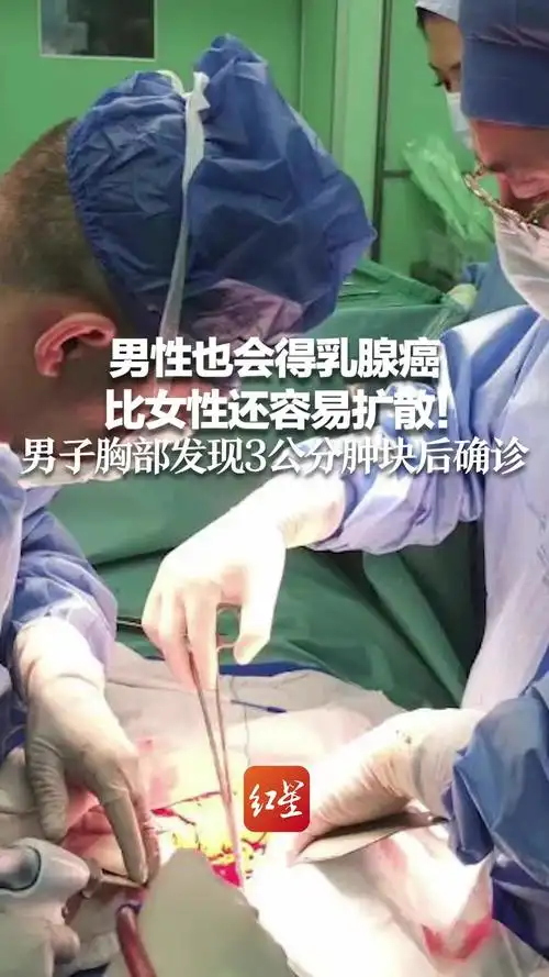 男性也会得乳腺癌,比女性还容易扩散!