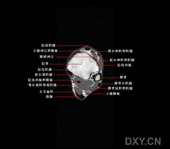 踝关节正常mri解剖图谱