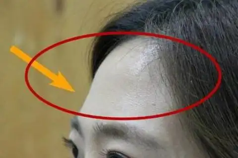 额头凹陷是富贵坑吗 额头凹陷面相运势好吗